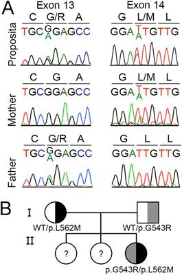 Functional characterization of novel compound heterozygous missense SLC5A5 gene variants causing congenital dyshormonogenic hypothyroidism